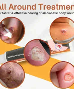 Fivfivgo™ Diabetic Wounds Treatment Cream