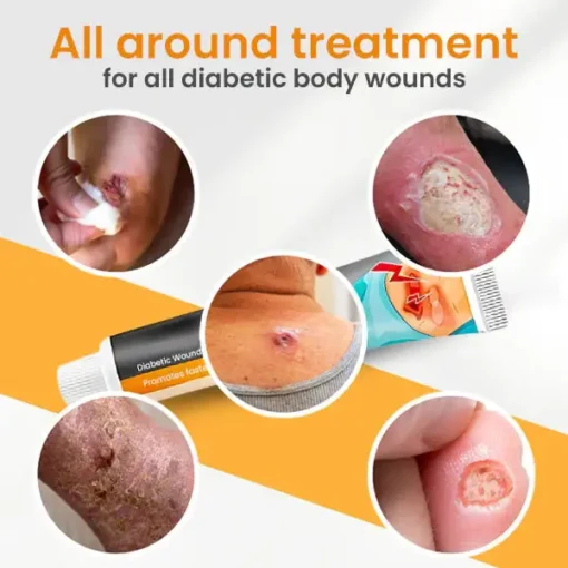 Fivfivgo™ Diabetic Wounds Treatment Cream