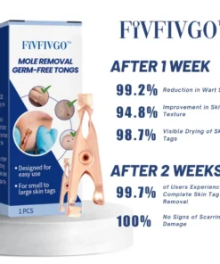 Fivfivgo™ Mole Removal Germ-Free Tongs