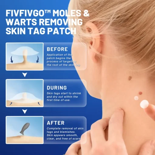 Fivfivgo™ Moles & Warts Removing Skin Tag Patch