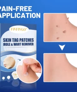 Fivfivgo™ Moles & Warts Removing Skin Tag Patch