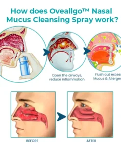 Fivfivgo™ Nasal Mucus Cleansing Spray