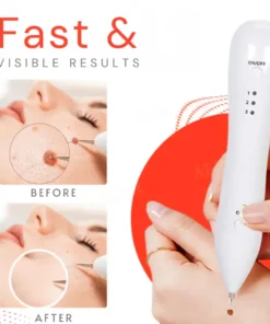 Fivfivgo™ Portable Skin Care Laser Pen