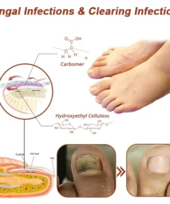 Fivfivgo™ Revolutionary High-Efficiency Light Therapy Device For Toenail Diseases