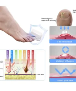 Fivfivgo™ Revolutionary High-Efficiency Light Therapy Device For Toenail Diseases