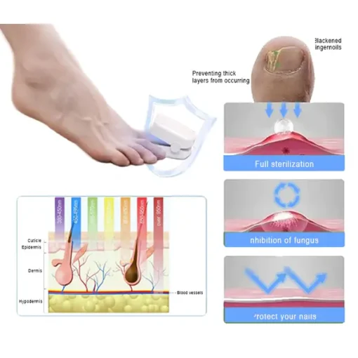 Fivfivgo™ Revolutionary High-Efficiency Light Therapy Device For Toenail Diseases