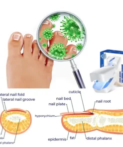 Fivfivgo™ Revolutionary High-Efficiency Light Therapy Device For Toenail Diseases