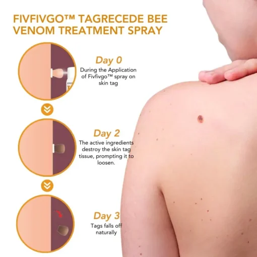 Fivfivgo™ TagRecede Bee Venom Treatment Spray