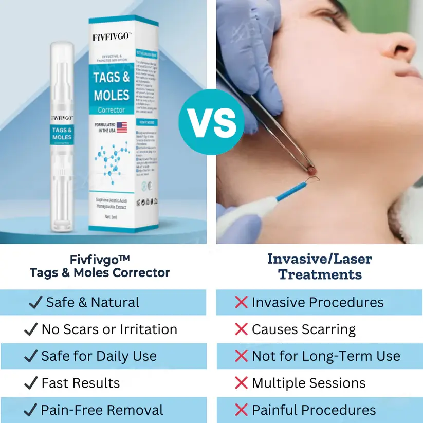 Fivfivgo™ Tags & Moles Corrector