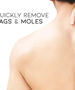 Fivfivgo™ Warts and Tags Removal Treatment Spray