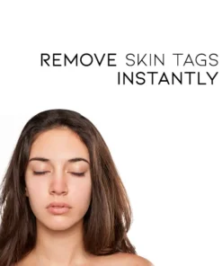 Fivfivgo™ WipeOff Tags & Mole Remover