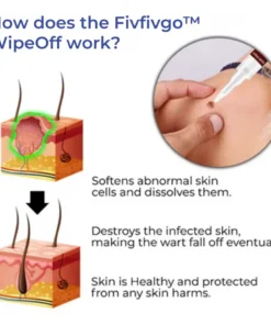 Fivfivgo™ WipeOff Tags & Moles Remover