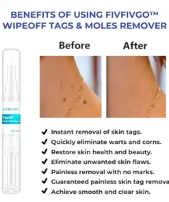 Fivfivgo™ WipeOff Tags & Moles Remover