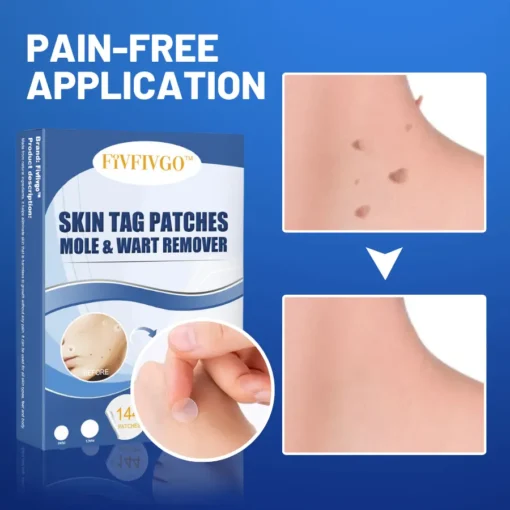 Fivfivgo™ Moles & Warts Removing Skin Tag Patch