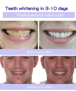 Fivfivgo™ Teeth Restoration Mineral Powder