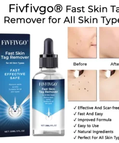 Fivfivgo® Fast Skin Tag Remover for All Skin Types