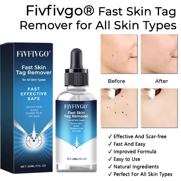 Fivfivgo® Fast Skin Tag Remover for All Skin Types