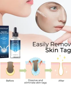 Fivfivgo® Fast Skin Tag Remover for All Skin Types