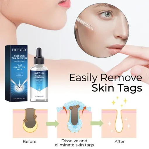 Fivfivgo® Fast Skin Tag Remover for All Skin Types