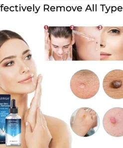 Fivfivgo® Fast Skin Tag Remover for All Skin Types