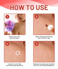 Fivfivgo® MicroDart Skin Tag Remover Patch
