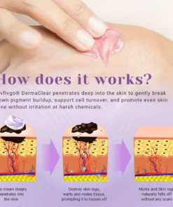 Fivfivgo® DermaClear Mole and Dark Spot Removal Bio-Gel