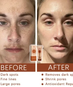 Fivfivgo™ Herbal Spots Peel-Off Facial Mask