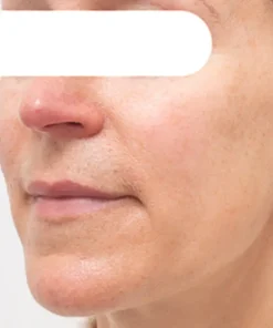 Fivfivgo™ Herbal Spots Peel-Off Facial Mask