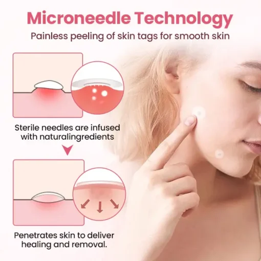 Fivfivgo® Painless Micro Wart Removal Patch