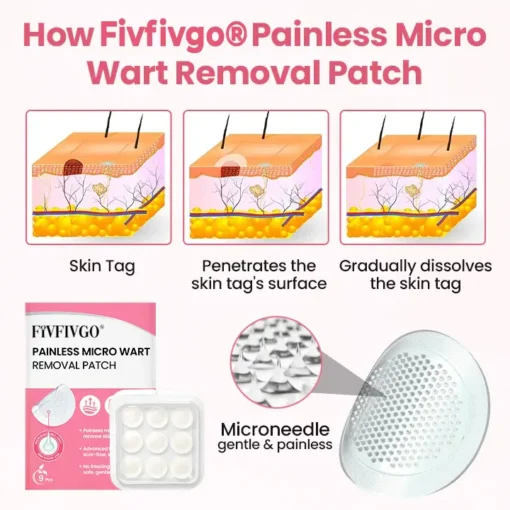 Fivfivgo® Painless Micro Wart Removal Patch