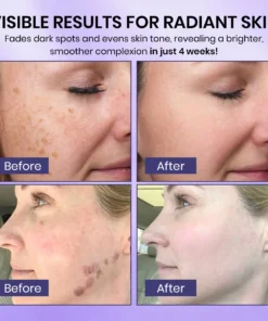Fivfivgo® Radiglow Brightening Dark Spot Gel