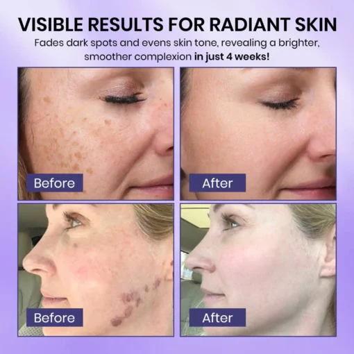 Fivfivgo® Radiglow Brightening Dark Spot Gel