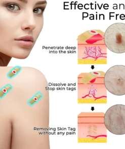 Fivfivgo™ Skin Tags & Mole Aftercare Protecting Patch