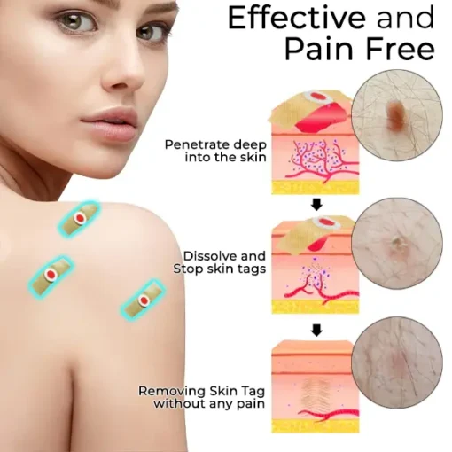Fivfivgo™ Skin Tags & Mole Aftercare Protecting Patch