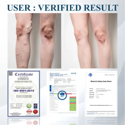 Fivfivgo® Black Cumin Edema Soothing Herbal Cream