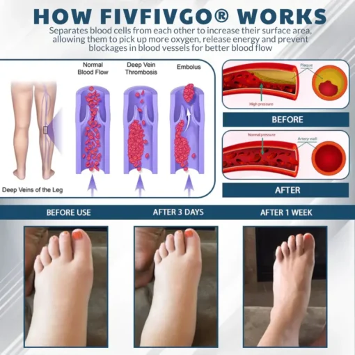 Fivfivgo® Black Cumin Edema Soothing Herbal Cream