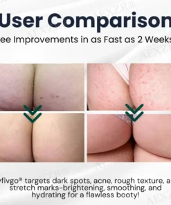 Fivfivgo® Butt Skin Treatment Cream