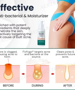 Fivfivgo® Butt Skin Treatment Cream