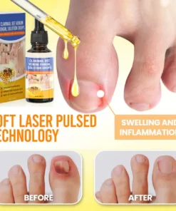 Fivfivgo® ClariNail Bee Venom Fungal Solution Drops
