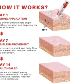 Fivfivgo® FloraGuard HPV Genital Warts Remover