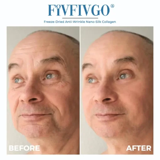 Fivfivgo® Freeze-Dried Anti-Wrinkle Nano-Silk Collagen