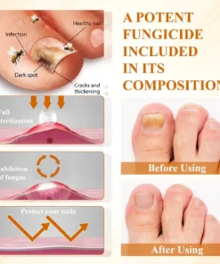 Fivfivgo® Fungiclear Bee Therapy Nail Spray