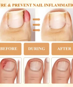 Fivfivgo® Fungiclear Bee Therapy Nail Spray