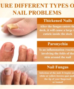 Fivfivgo® Fungiclear Bee Therapy Nail Spray