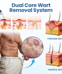 Fivfivgo® GentX WartRelief Cream