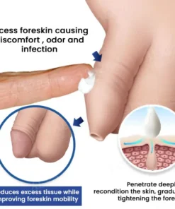 Fivfivgo® Glans Whitening & Foreskin Corrector Cream