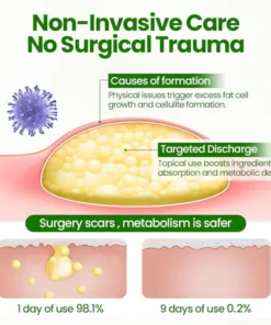 Fivfivgo® KnotAway Lipoma Removal Cream
