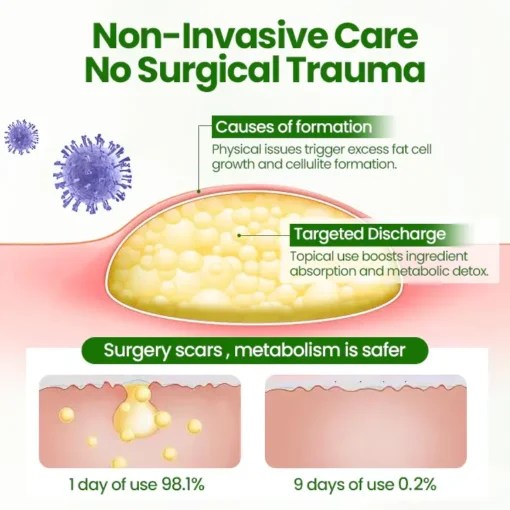 Fivfivgo® KnotAway Lipoma Removal Cream