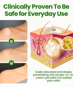 Fivfivgo® KnotAway Lipoma Removal Cream