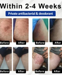Fivfivgo® LicorRelief Man Genital Antifungal Cream